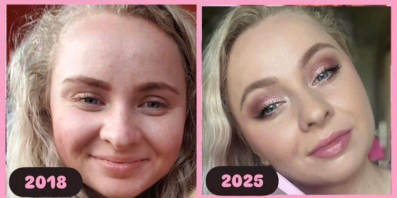 Proměna pleti Kristýny Markové — srovnání 2018 a 2025